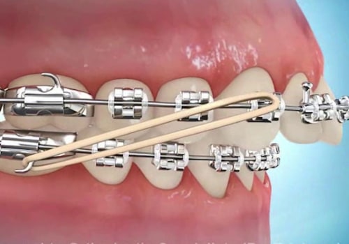 Understanding the Different Types of Personal Dosimetry